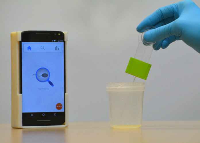 El analizador de semen para teléfonos inteligentes. / Vignesh Natarajan