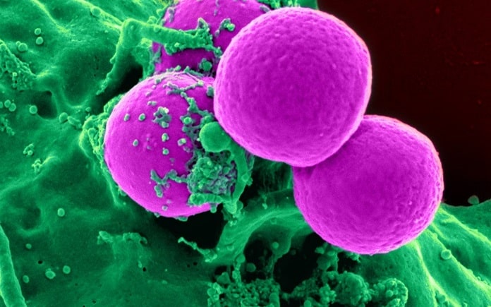 Un kit para detectar ‘células asesinas’ de embriones