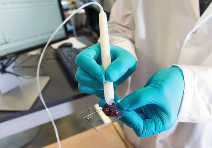 Un dispositivo identifica en segundos el tejido canceroso durante la cirugía / Vivian Abagiu / UT Austin