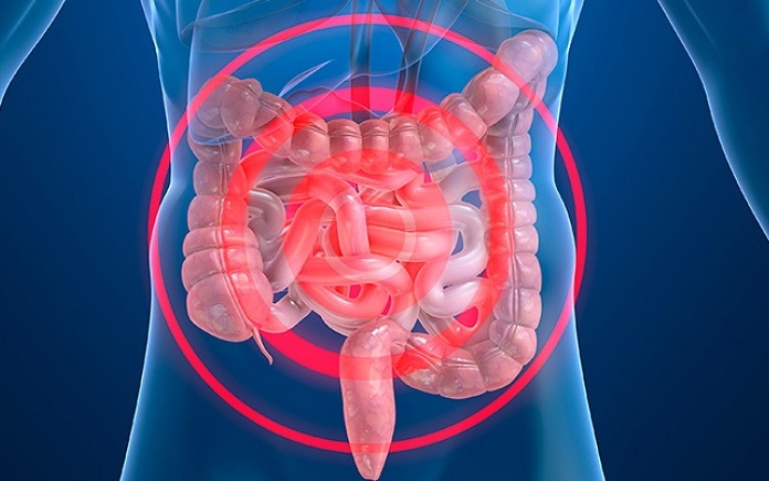 enfermedades inflamatorias intestinales