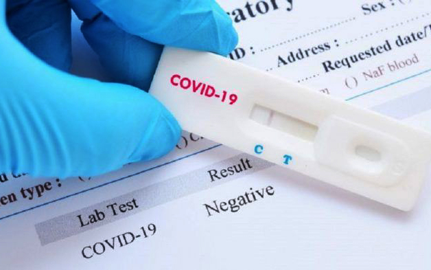 COVID-19 pruebas rapidas de diagnostico