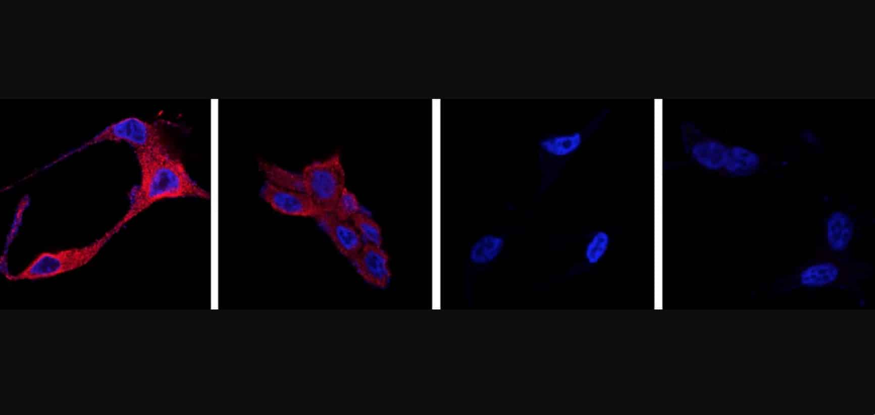 CSIC nanoparticulas cancer de prostata