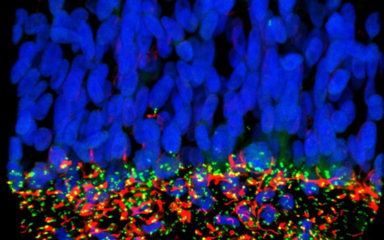 virus zika CSIC microcefalia antivirales