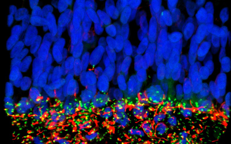 virus zika CSIC microcefalia antivirales