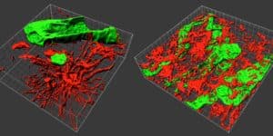 glioblastoma biopsia 3d carlos barcia