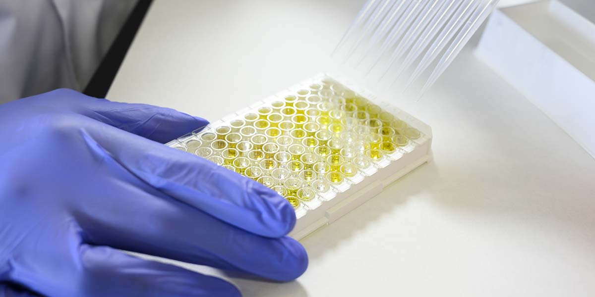 coronavirus test csic