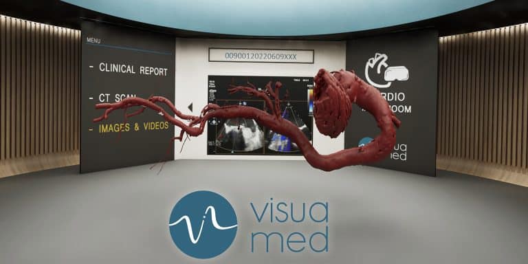 visuamed helena ortiz victor herrera cirugía cardiobvascular realidad virtual salud medicina imagen médica lanzadera juan roig