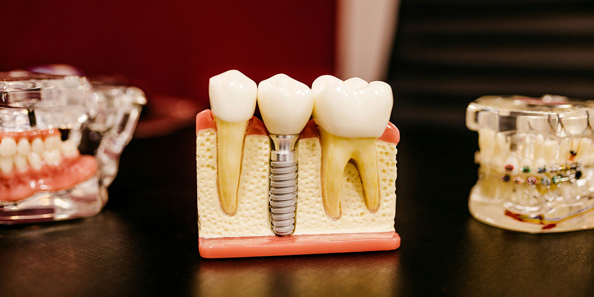 Endodoncia