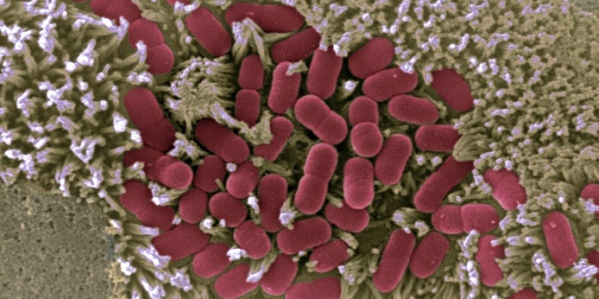 Ecoli