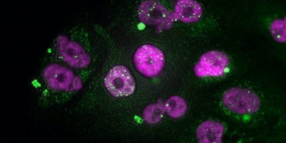 inhibidores moléculas quimioterapia