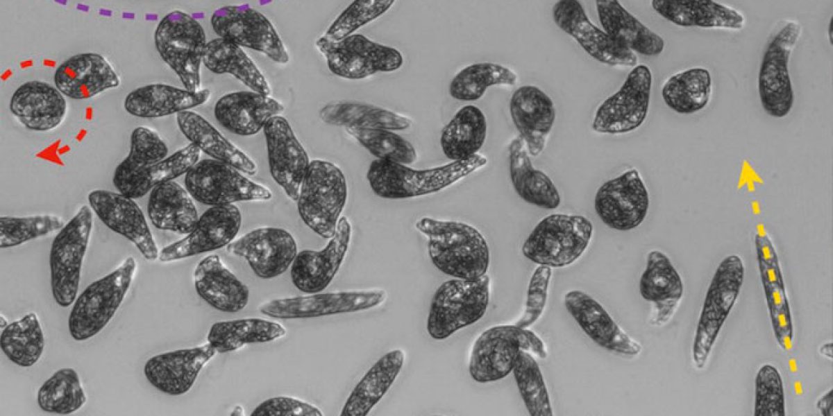 Imagen microscópica del cultivo y movimiento de la Euglena en ambientes abarrotados