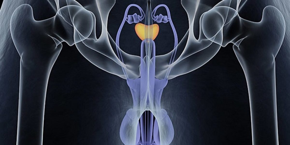 cancer prostata