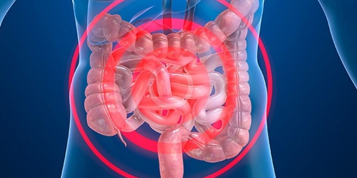 enfermedades inflamatorias intestinales