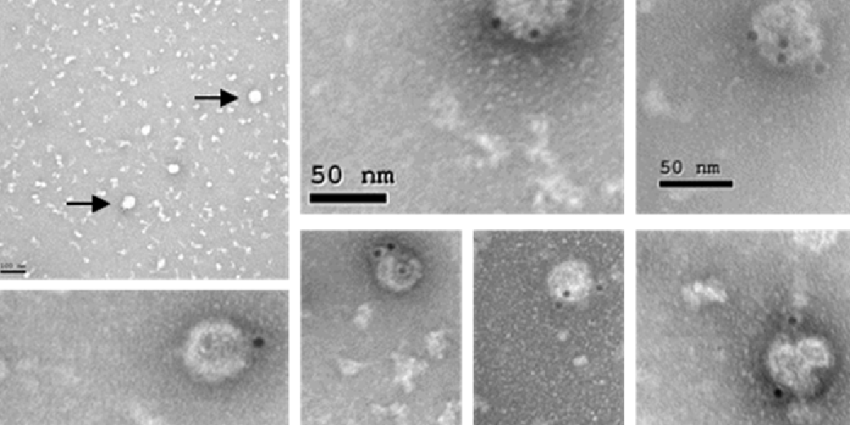 Detección mediante microscopía electrónica de partículas virales semejantes al virus del Zika generadas por la vacuna MVA-ZIKV. / CSIC