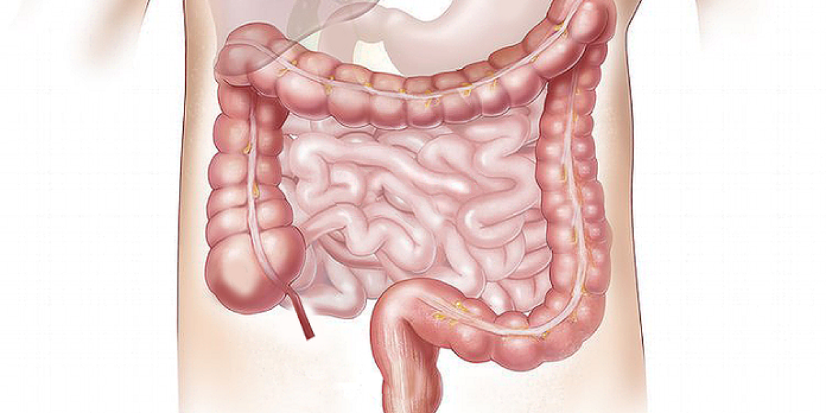 nanofarmaco cancer colorrectal