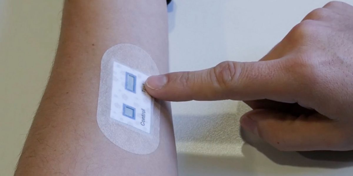 Investigadores del CSIC han desarrollado un parche para el diagnóstico de la fibrosis quística