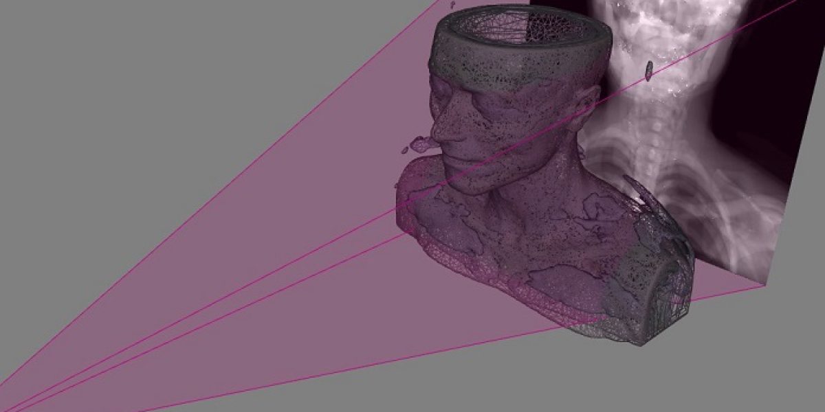 radiografias 3D