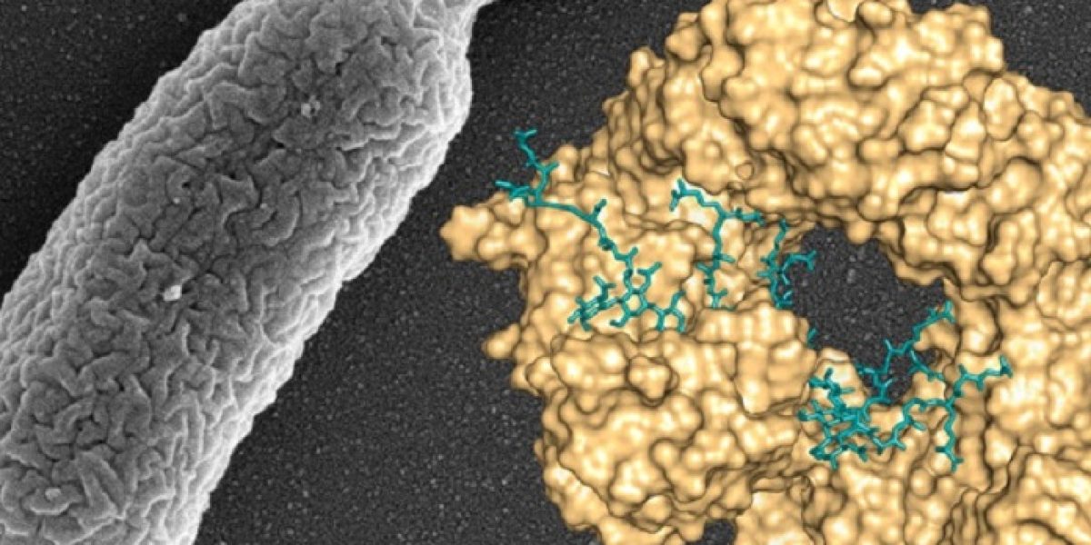 bacterias multiresistentes