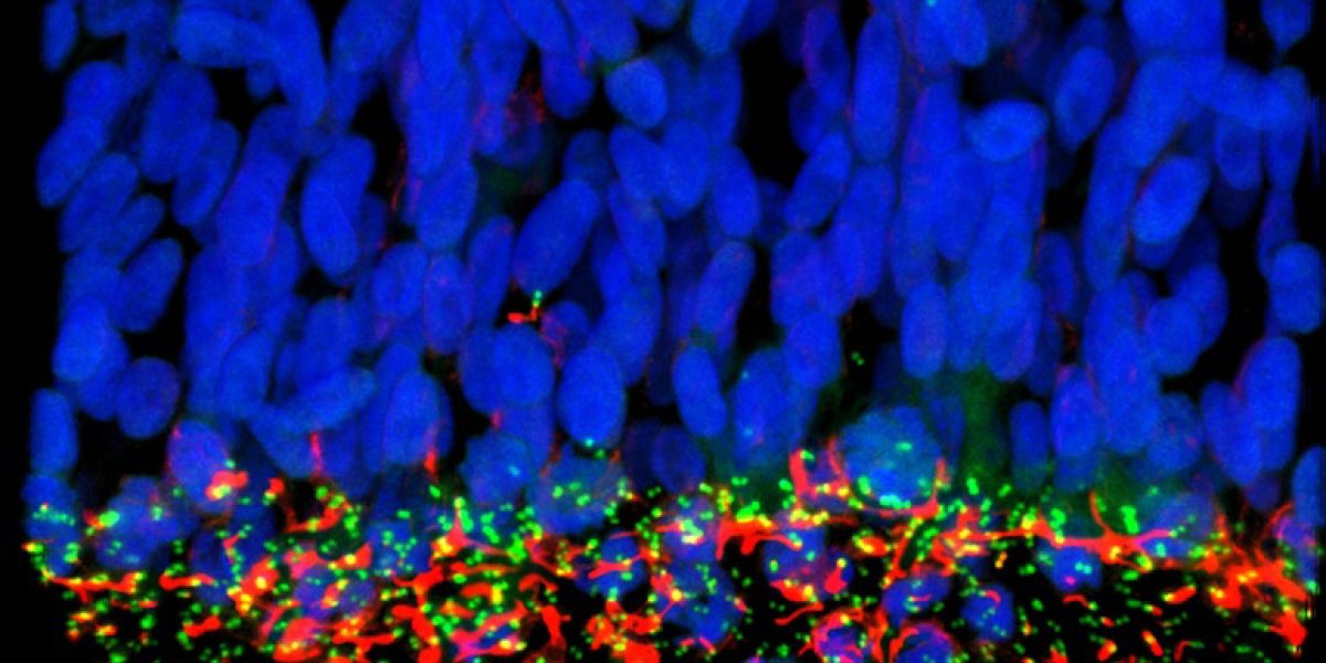 virus zika CSIC microcefalia antivirales